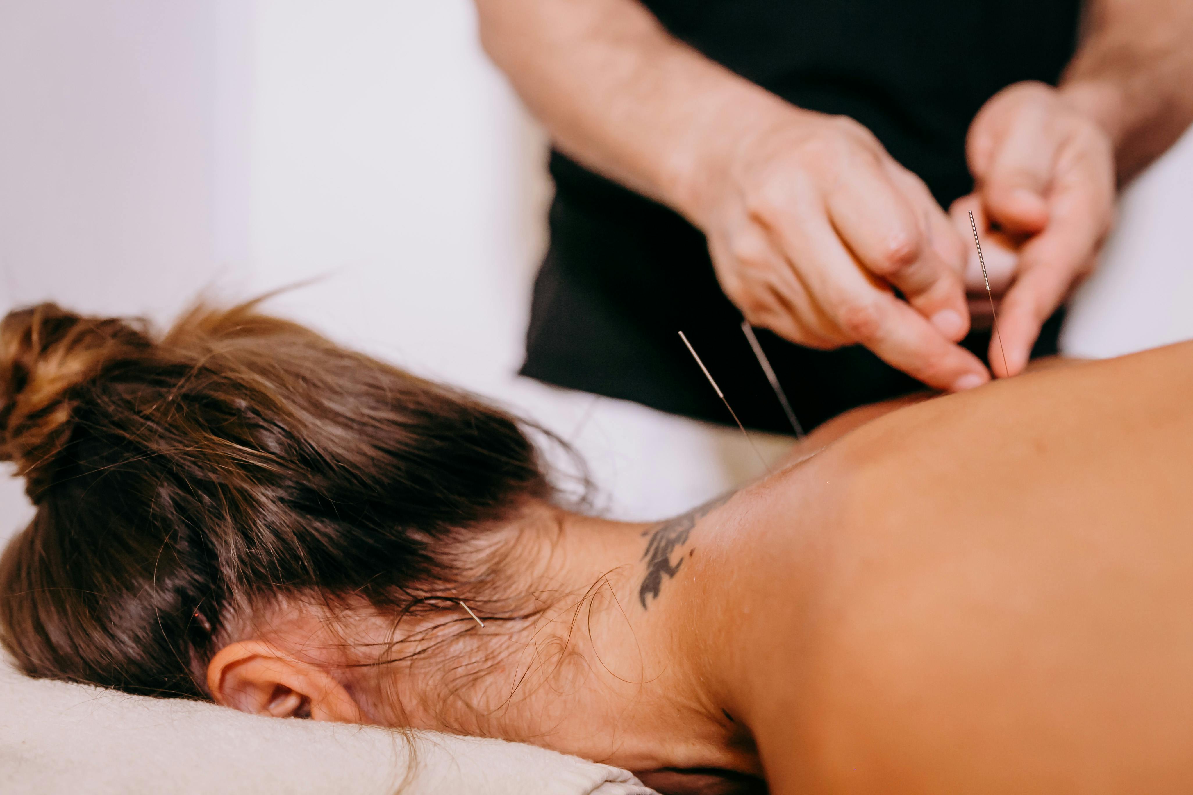 IMS/Dry Needling
